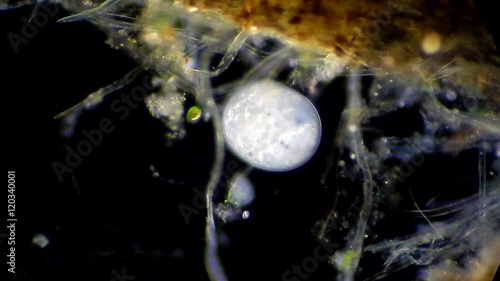 Living cells infusoria under microscope