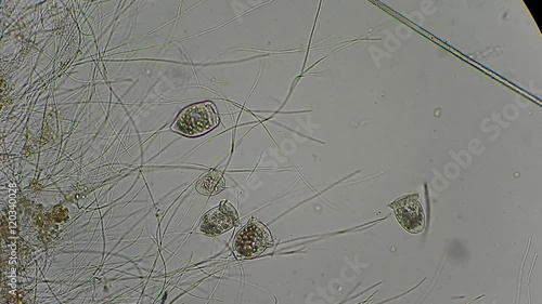 vorticella and rotifers filtrating water under microscope 400x