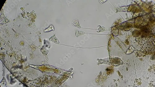 vorticella and rotifers filtrating water under microscope 400x