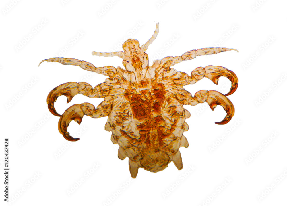 Pediculus humanus - head louse,permanent slide plate under high ...