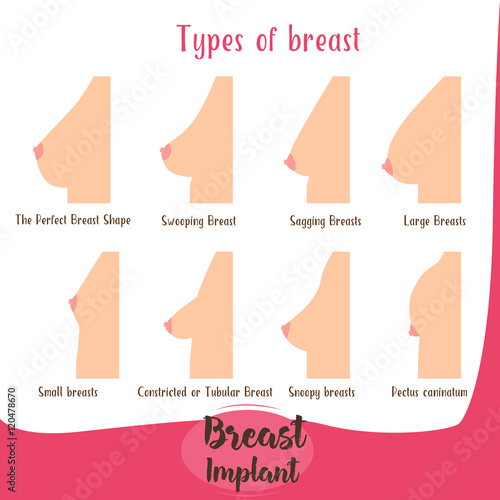 The various forms of chest set . Female body .Vektor
