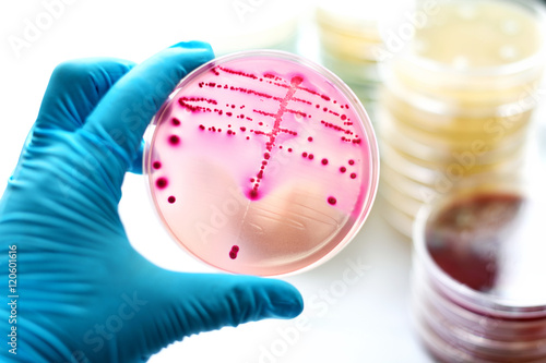 Foto Colonies of bacteria in MacConkey agar
