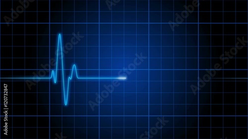 EKG 001: An electrocardiogram heart monitor pulses on a blue grid (Loop).