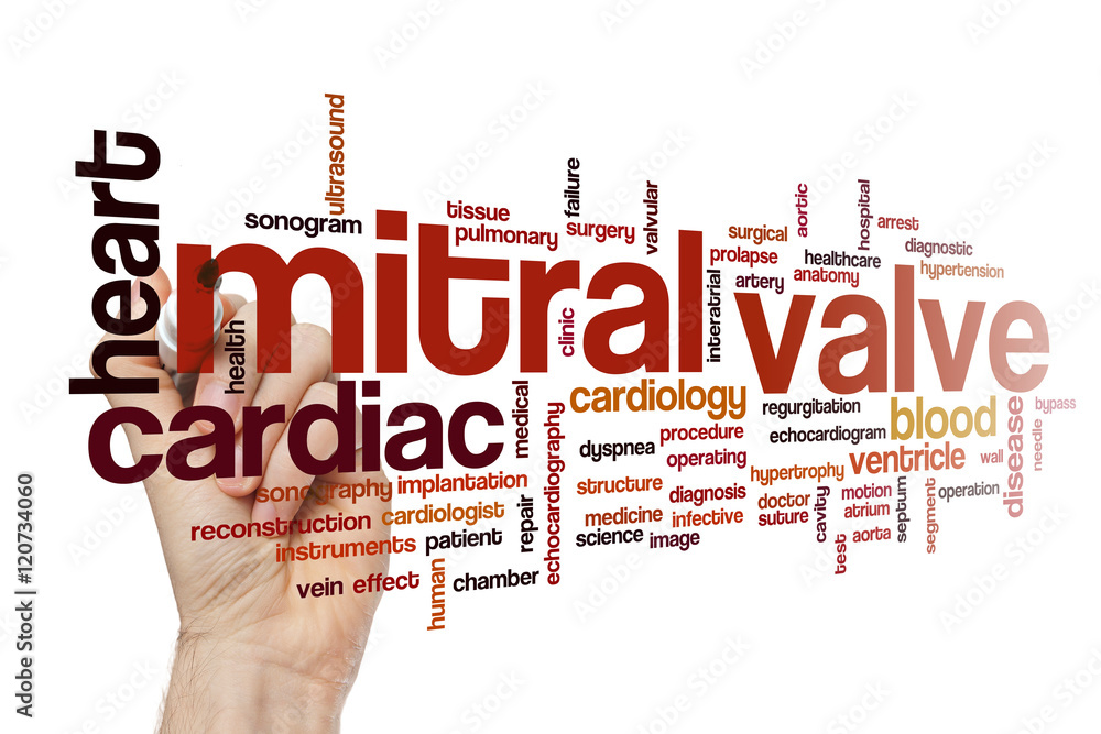 Mitral valve word cloud concept Mitral valve word cloud concept