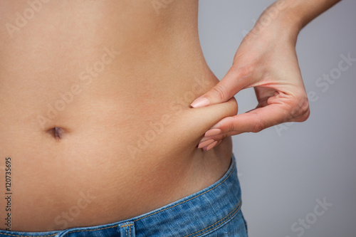 She pulls the hand skin showing fat in the abdomen and flanks. Treatment and disposal of excess weight, the deposition of subcutaneous fat tissue.