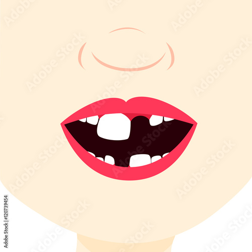 Toothless child smiling and showing milk tooth and permanent teeth in eruption. Close up in the mouth.