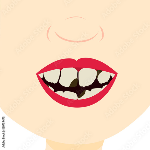 Child smiling and showing dirty, broken and decayed teeth. Close up in the mouth.