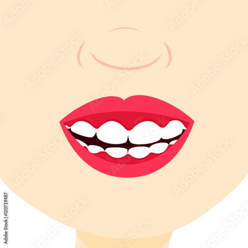 Child smiling and showing inflamed gingiva. Gingival problemGingivitis problem. Close up in the mouth.