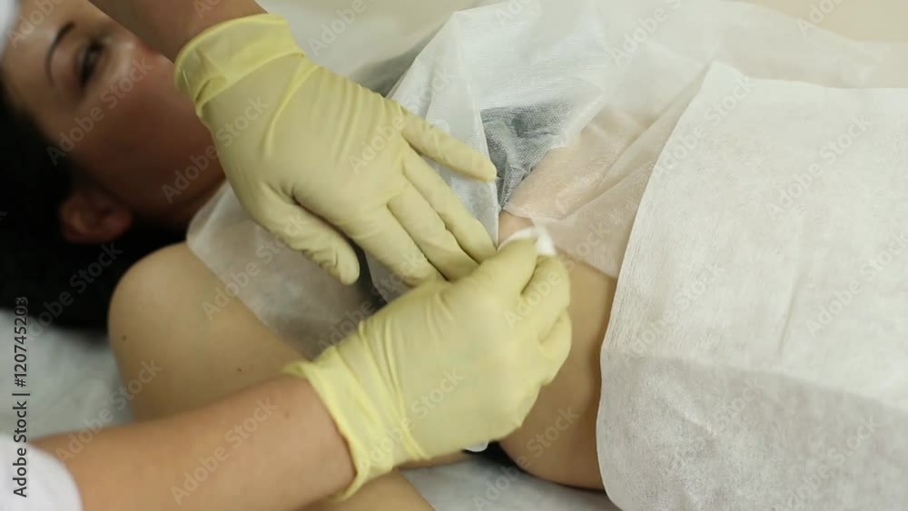 Prepare The Patient For Injection Anesthesia Prepare The Patient For Injection Anesthesia