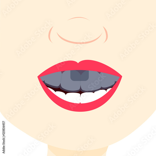 Smile and showing teeth with dental tray. Dental treatment. Close up in the mouth.