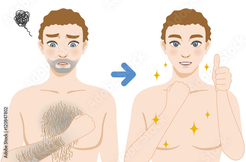 men'a hair removal before after concept, unwanted hair, superfluous hair, vector illustration