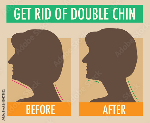 Reduce double chin. Get rid of face and neck fat concept.