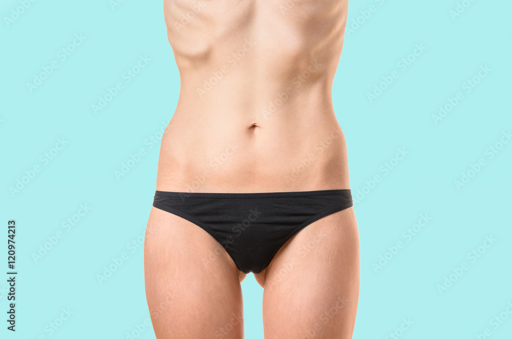 Very thin woman suffering from extreme dieting Very thin woman suffering from extreme dieting