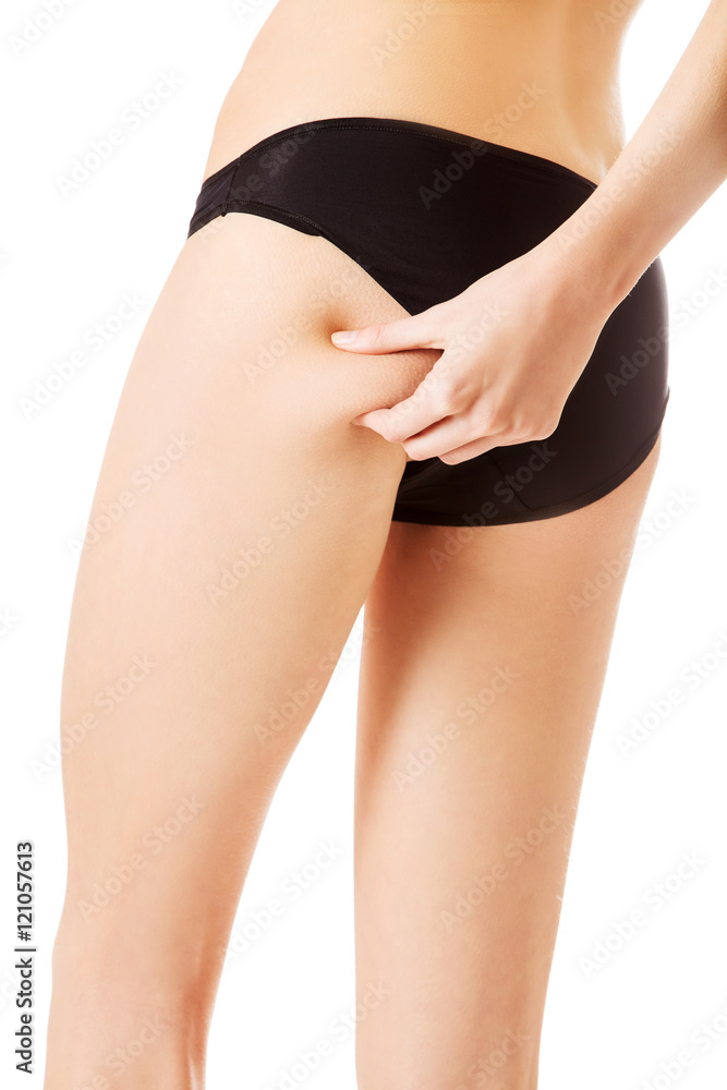 Female squeezes cellulite skin on her legs. Close-up shot on white background.