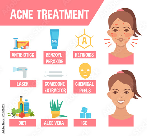 acne treatment