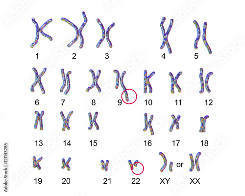 Obraz na plátně Philadelphia chromosome karyotype