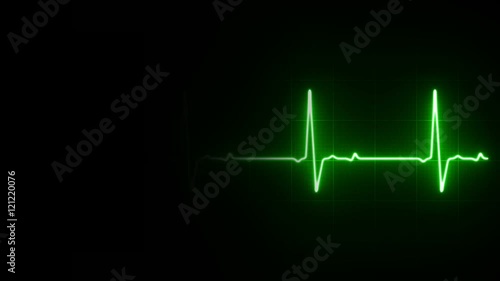 EKG Heart Line Footage Loop