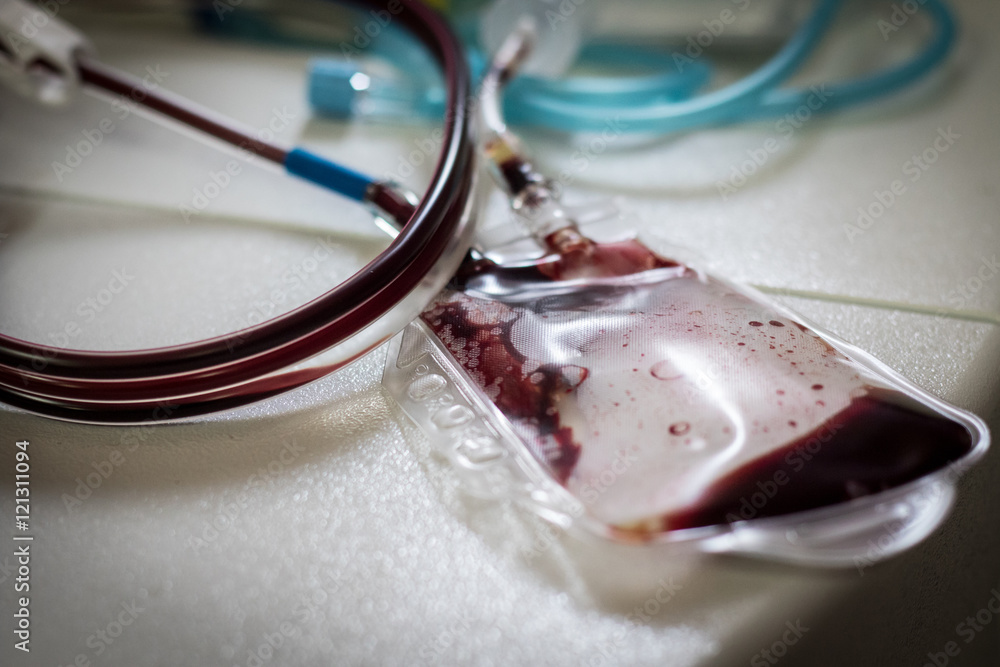 blood bag on the single donor platelets blood separation machine blood bag on the single donor platelets blood separation machine