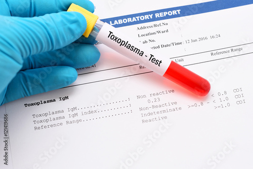 Blood sample with Toxoplasma testing result photo