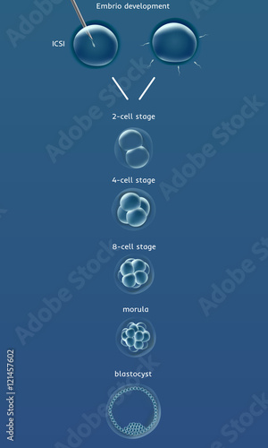 Embriogenesis embrio genesis . In vitro fertilization IVF . Artificial insemination. ICSI. Male infertility. Illustration for web or typography magazine, brochure, flyer, poster .