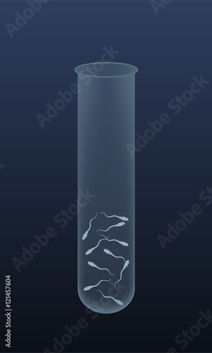 Spermatozoons sperm in a test-tube. In vitro fertilization IVF . Artificial insemination. Spermogram. Male infertility. Illustration for web or typography magazine, brochure, flyer, poster .