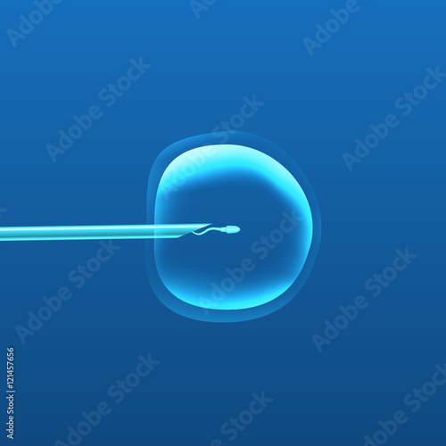 In vitro fertilization IVF . Artificial insemination. ICSI. The ovum egg , needle and spermatozoon. Illustration for web or typography magazine, brochure, flyer, poster .