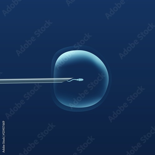 In vitro fertilization IVF . Artificial insemination. ICSI. The ovum egg , needle and spermatozoon. Illustration for web or typography magazine, brochure, flyer, poster .