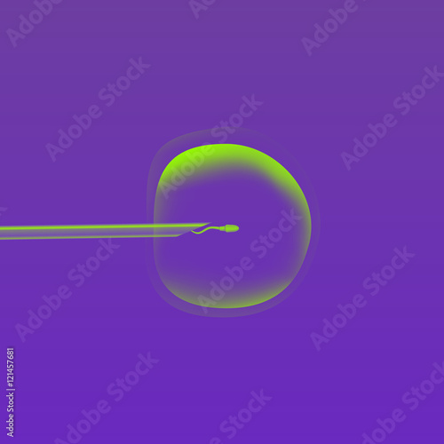 In vitro fertilization IVF . Artificial insemination. ICSI. The ovum egg , needle and spermatozoon. Illustration for web or typography magazine, brochure, flyer, poster .