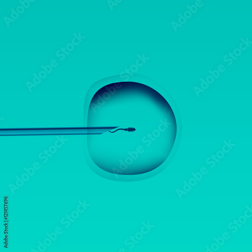 In vitro fertilization IVF . Artificial insemination. ICSI. The ovum egg , needle and spermatozoon. Illustration for web or typography magazine, brochure, flyer, poster .