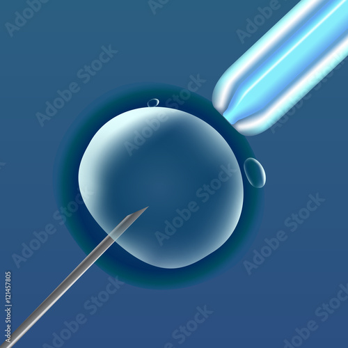 In vitro fertilization IVF , the egg ovum , pipette and pipe diagonal, reproduction in humans illustration for an article, site or typography magazine, brochure, flyer, poster , blue.