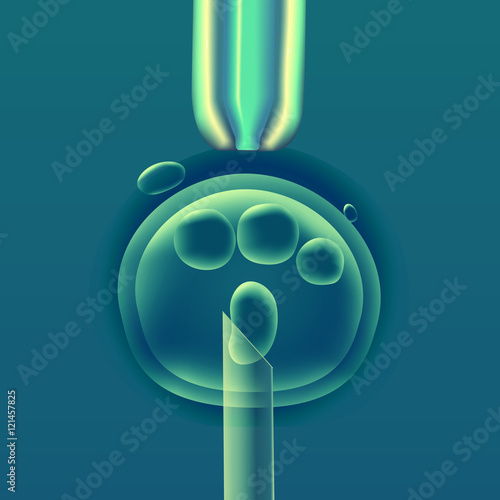 In vitro fertilization IVF , the egg ovum , pipette and pipe vertical, reproduction in humans illustration for an article, site or typography magazine, brochure, flyer, poster , colorful.