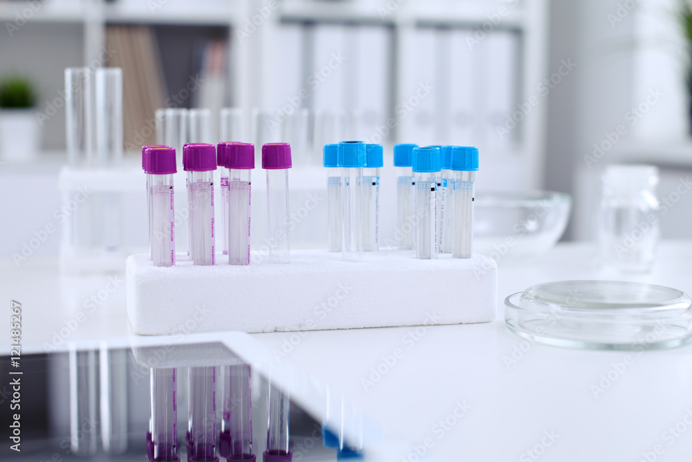 Research laboratory working space. Test tubes and tablet PC are lying at the table. Medical equipment. Blood test Research laboratory working space. Test tubes and tablet PC are lying at the table. Medical equipment. Blood test