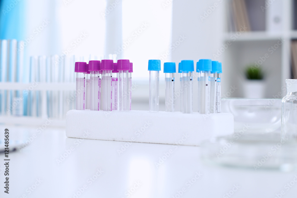 Research laboratory working space. Test tubes and tablet PC are lying at the table. Medical equipment. Blood test Research laboratory working space. Test tubes and tablet PC are lying at the table. Medical equipment. Blood test