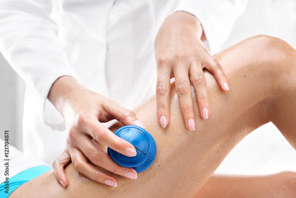 Kosmetyczka masuje uda kobiety gumowymi bańkami do masażu. - obrazy, fototapety, plakaty 