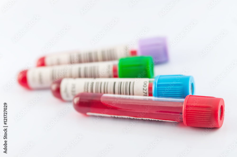 Medical Blood tube, test tube for laboratory on white background Medical Blood tube, test tube for laboratory on white background