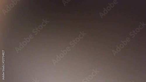 Eye Exam from Patient's Point of View