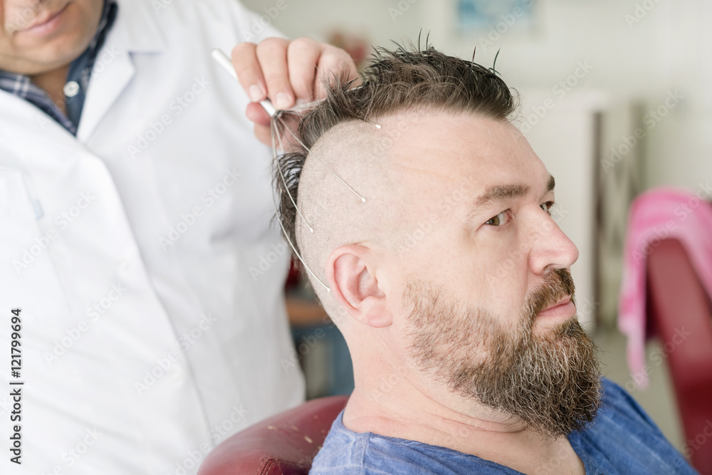 Obraz premium Male barber doing massage capillary head massager of a man