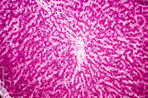 Light micrograph of a liver showing cords made from hepatocytes and clear spaces between them called hepatic sinusoids and filled with red blood cells. Magnification 200x photo