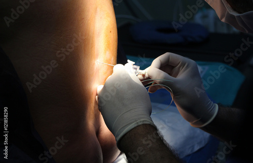 epidural anesthesia photo