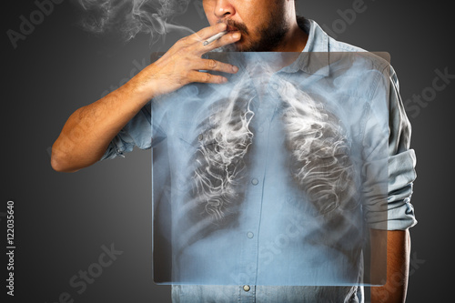 Man smoking with x-ray lung, Isolated on grey background