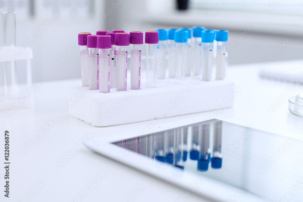 Research laboratory working space. Test tubes and tablet PC are lying at the table. Medical equipment. Blood test Research laboratory working space. Test tubes and tablet PC are lying at the table. Medical equipment. Blood test