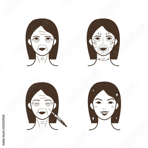 Facial injections