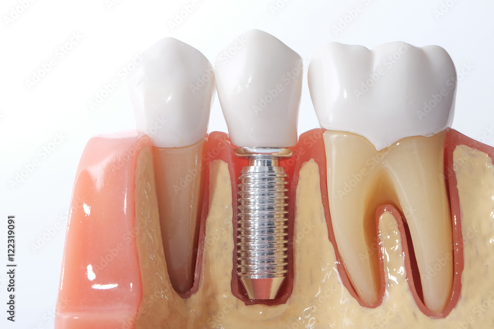 Naklejka premium Generic dental teeth model