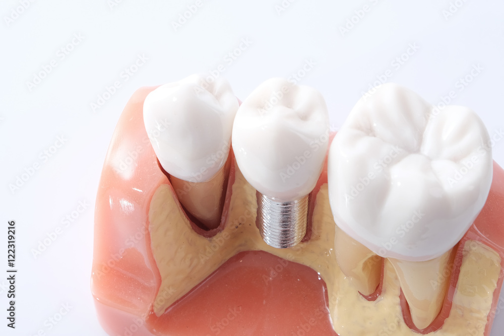 Naklejka premium Generic dental teeth model