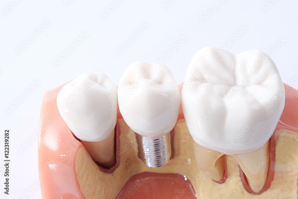 Generic dental teeth model Generic dental teeth model