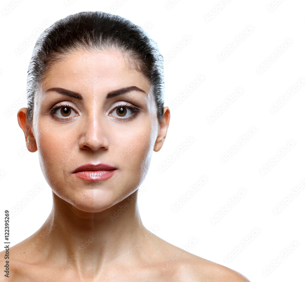 Woman face before and after cosmetic procedure. Plastic surgery concept. Woman face before and after cosmetic procedure. Plastic surgery concept.