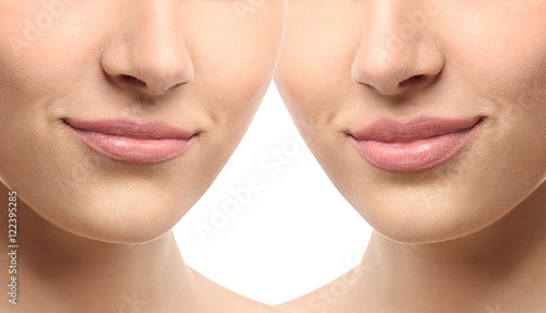 Woman lips before and after...