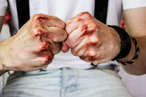Fotografía Puños de un hombre joven con sangre en los nudillos