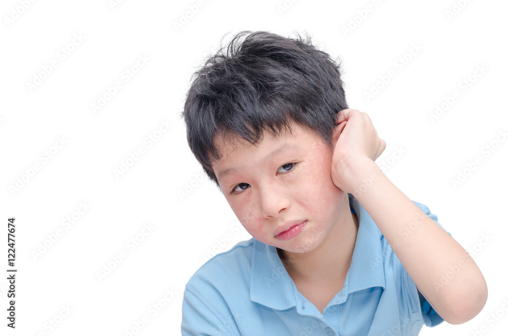 Young asian boy scratching his allergy skin Young asian boy scratching his allergy skin