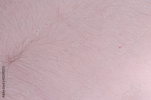 Small magenta dot's on the skin. photo